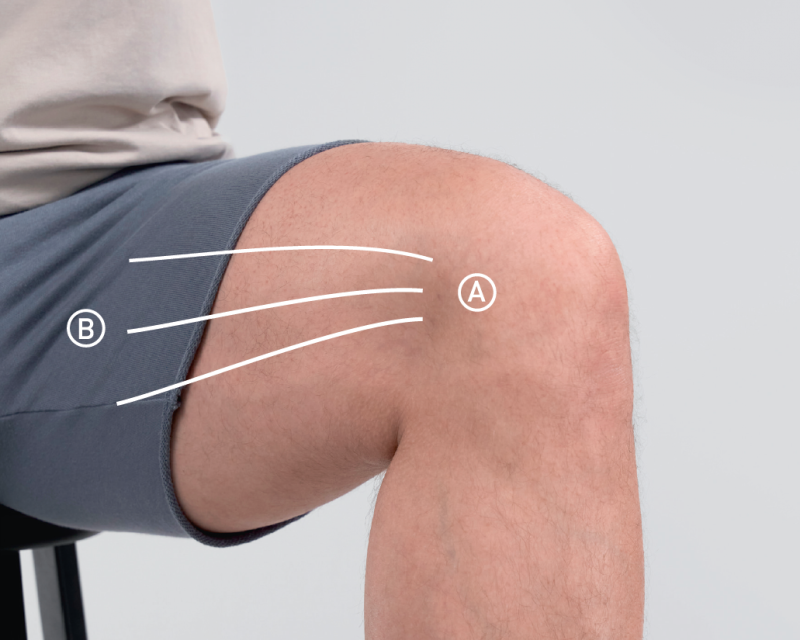 Arthrose Schritt 3