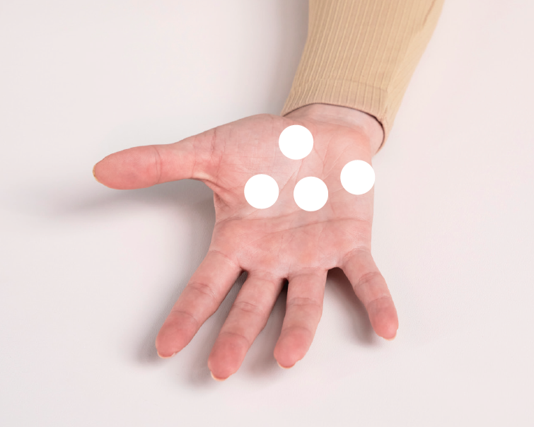 Handtherapie Schritt 2