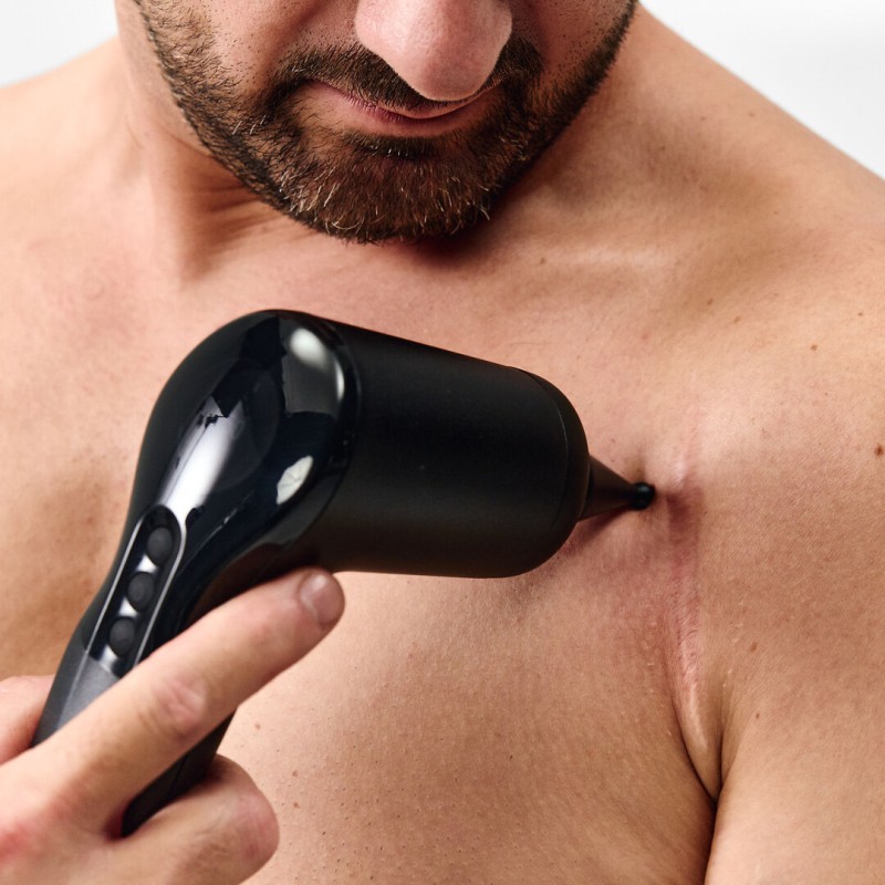 Kieferöffnungsstörung, Hilfsmuskulatur, Kausystem